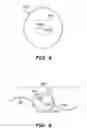 Fig. 06 - Method and system for modifying eye tissue and intraocular lenses