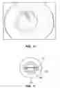 Fig. 08 - Method and system for modifying eye tissue and intraocular lenses
