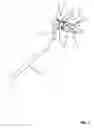 Fig. 02 - Device for applying a marking to the human eye