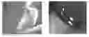 Fig. 01 - ARTIFICIAL TEAR COMPOSITIONS AND METHODS OF USE THEREOF