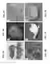 Fig. 04 - Use of decellularized extracellular matrix for encapsulating cells