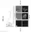 Fig. 08 - Use of decellularized extracellular matrix for encapsulating cells