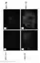 Fig. 09 - Use of decellularized extracellular matrix for encapsulating cells