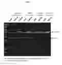 Fig. 06 - POLYNUCLEOTIDES ENCODING METHYLMALONYL-CoA MUTASE