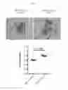 Fig. 06 - BETA-GLUCAN IMMUNOTHERAPIES AFFECTING THE IMMUNE MICROENVIRONMENT