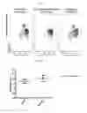 Fig. 33 - BETA-GLUCAN IMMUNOTHERAPIES AFFECTING THE IMMUNE MICROENVIRONMENT