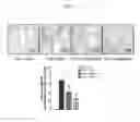 Fig. 02 - Compositions and methods for treating or ameliorating fibrosis, systemic sclerosis and scleroderma