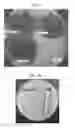 Fig. 02 - Compositions and Methods for Treating Acne
