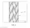 Fig. 03 - SUTURE MATERIAL HAVING BENEFICIAL PHYSICAL PROPERTIES