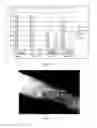 Fig. 08 - ACID FUNCTIONALISED COATED MEDICAL DEVICE AND METHOD OF COATING SUCH A DEVICE