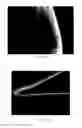 Fig. 09 - ACID FUNCTIONALISED COATED MEDICAL DEVICE AND METHOD OF COATING SUCH A DEVICE