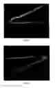 Fig. 10 - ACID FUNCTIONALISED COATED MEDICAL DEVICE AND METHOD OF COATING SUCH A DEVICE