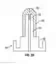 Fig. 09 - Systems and methods to improve instrument guidance within an intravenous catheter assembly