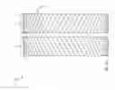Fig. 02 - Advanced herringbone gear design