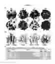 Fig. 12 - Polypeptides and medical uses thereof