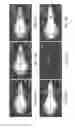 Fig. 15 - Chimeric alkaline phosphatase-like proteins