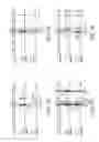Fig. 07 - Diesel engine dual fuel injection strategy