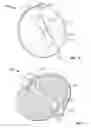 Fig. 07 - Butterfly valve