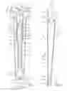 Fig. 02 - Protective casings for gauge assemblies having gauges and hoses