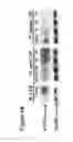 Fig. 20 - Methods to identify and treat subjects having corticosteroid-resistant inflammatory diseases