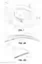 Fig. 02 - Contact lens with metered liquid system