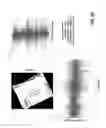 Fig. 07 - Persistent feature based image rotation and candidate region of interest
