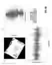 Fig. 08 - Persistent feature based image rotation and candidate region of interest