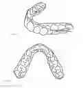 Fig. 09 - Method for analyzing an image of a dental arch