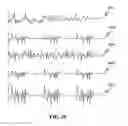 Fig. 11 - METHOD AND SYSTEM FOR FACILITATING DECOMPOSITION OF SOUND SIGNALS