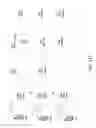 Fig. 24 - Scalable coding based video distribution
