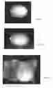 Fig. 02 - METHODS FOR GENDER DETERMINATION OF AVIAN EMBRYOS IN UNHATCHED EGGS AND MEANS THEREOF