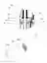 Fig. 07 - Electronic cigarette