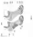 Fig. 02 - Sock with Trigonomic Arch Support