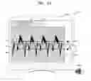 Fig. 07 - Method for outputting speed of object and ultrasonic diagnosis device therefor