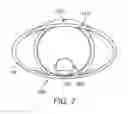 Fig. 08 - Implantable devices and related methods for heart failure monitoring