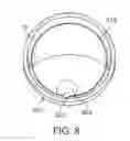 Fig. 09 - Implantable devices and related methods for heart failure monitoring