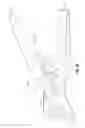 Fig. 06 - Electrosurgical scissors