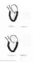 Fig. 02 - Heart valve repair method