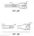 Fig. 71 - Methods of managing neurovascular obstructions