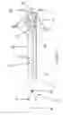 Fig. 02 - Method and catheter for creating an interatrial aperture
