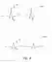 Fig. 07 - Electrode assembly with thermal shunt member