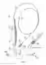 Fig. 02 - CATHETER APPARATUS HAVING STABILIZED INTERSTICES, SYSTEM THEREOF AND METHODS THEREOF