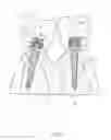 Fig. 05 - METHOD FOR CORRECTING A DENTAL PROSTHETIC MOUNTED UPON AN ANGULARLY-OFFSET INSTALLED ONE-PIECE MINIATURE DENTAL IMPLANT