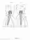 Fig. 06 - METHOD FOR CORRECTING A DENTAL PROSTHETIC MOUNTED UPON AN ANGULARLY-OFFSET INSTALLED ONE-PIECE MINIATURE DENTAL IMPLANT