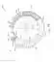 Fig. 22 - Magnetic sphincter replacement device with internal seals
