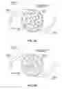 Fig. 04 - Birefringent intraocular lens