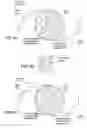 Fig. 08 - Birefringent intraocular lens