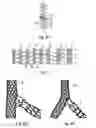 Fig. 03 - Branch stent