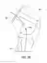 Fig. 09 - Flexible support brace for ankle