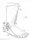 Fig. 01 - Ankle flexible support system